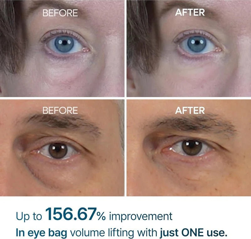 Eyephalt Eyecream