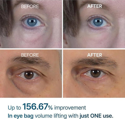Eyephalt Eyecream